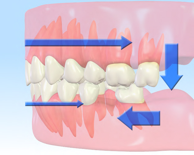 裁断済】成功に導くための基準とステップがわかる前歯部審美治療の