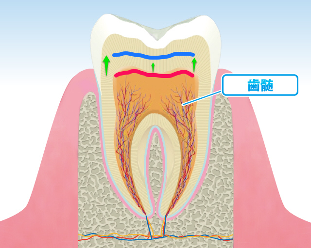歯髄の位置